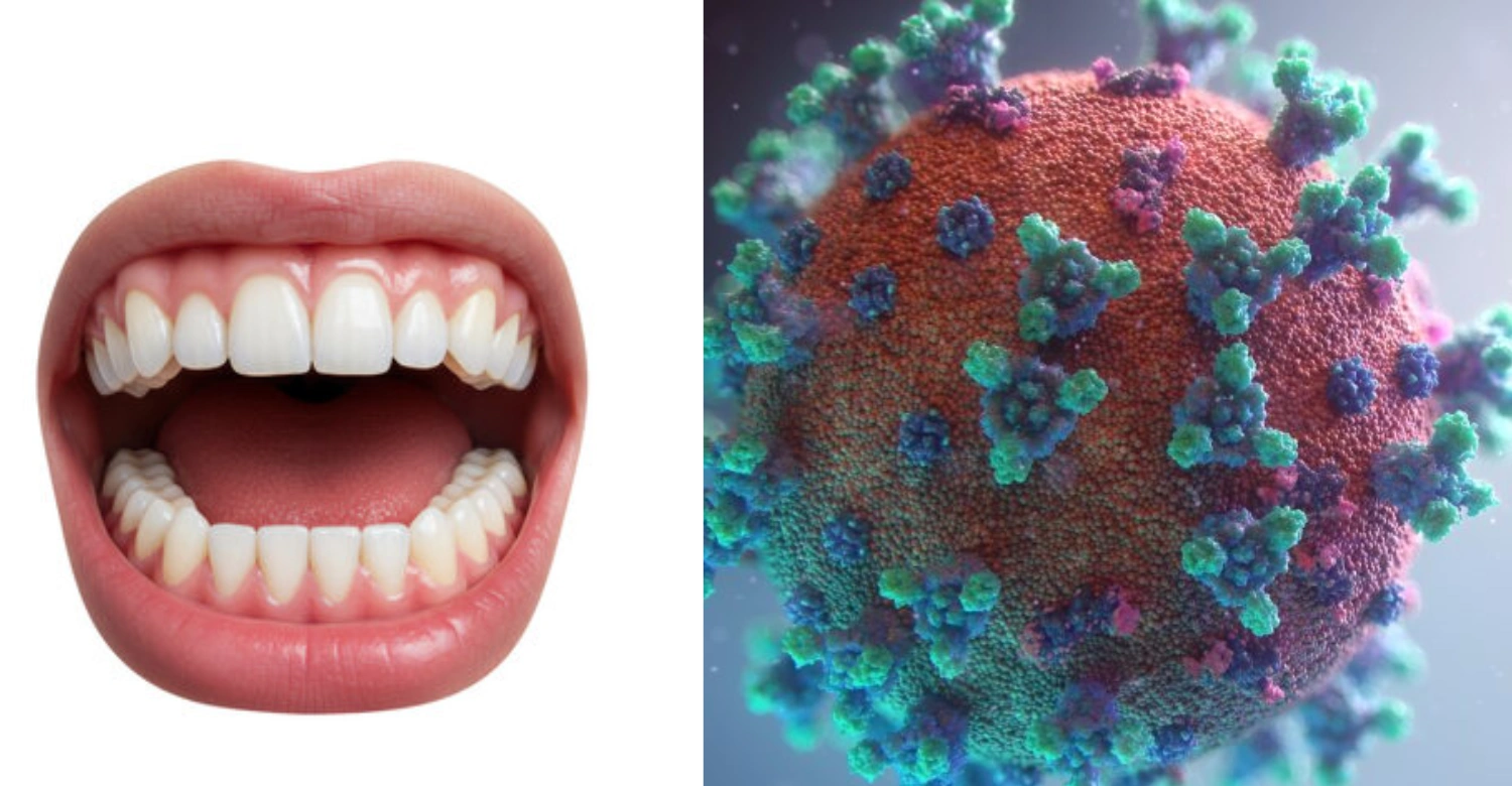 HIV Symptoms and Oral Health 2